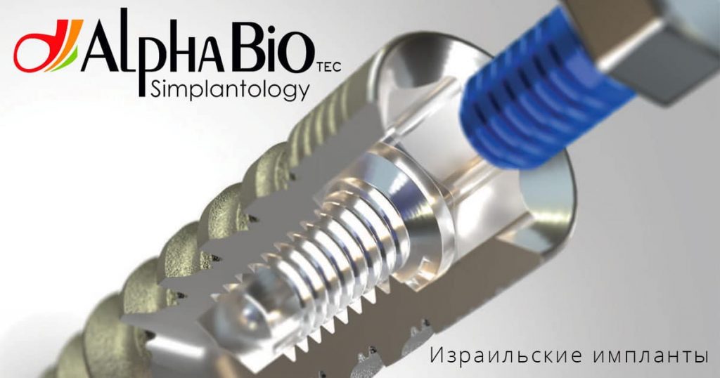 Импланты Alpha Bio