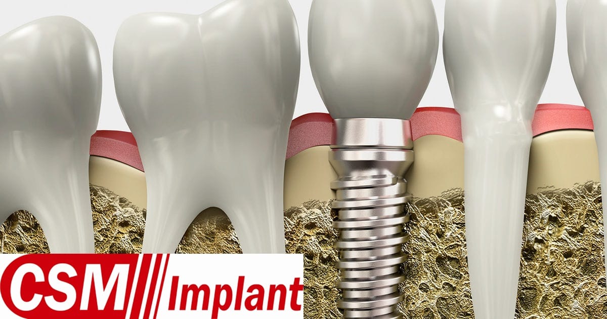 импланты CSM Implant