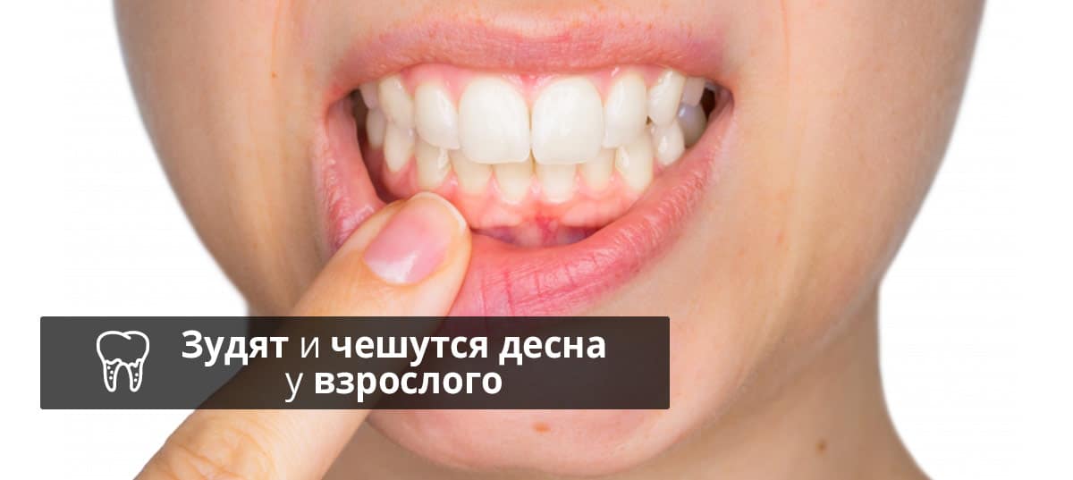 Что стоматологи называют воспалением десны?