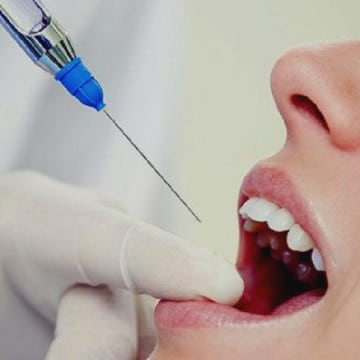 как лечат пульпит зуба