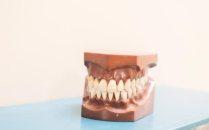 Альтернатива имплантации двух зубов