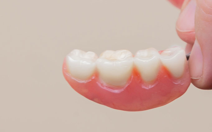 Что такое акриловые зубные протезы?