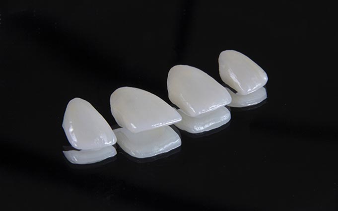 Коронки на передние зубы: актуальные виды лечения