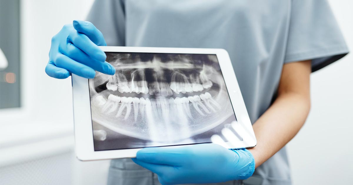 Ортопантомограмма — панорамный снимок зубов