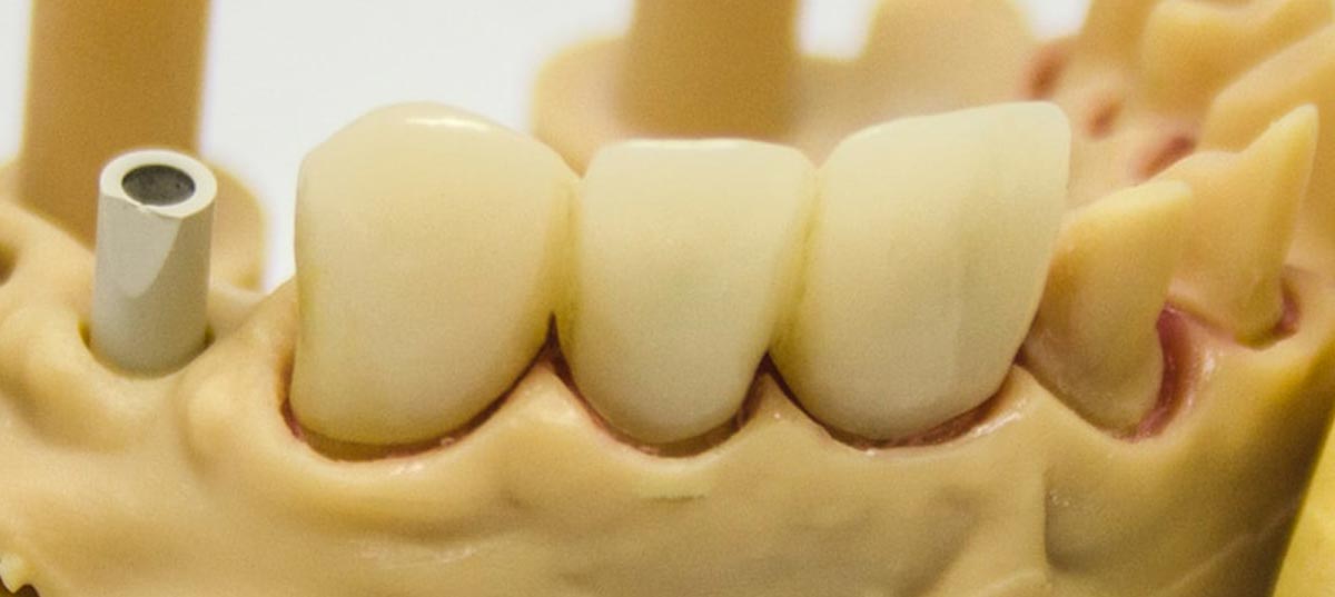 Желтые зубы – что делать?