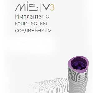 Импланты MIS V3
